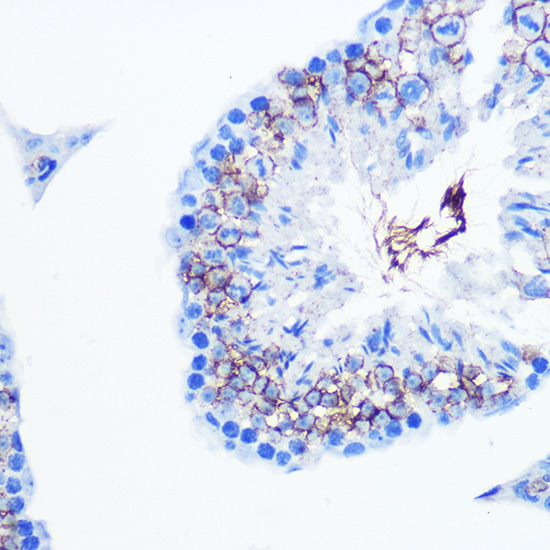 Anti-SLC6A4 Antibody (CAB14171)