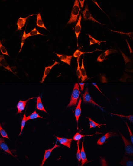 Anti-RAB7A Antibody (CAB12784)