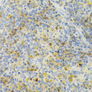 Anti-PAK1 Antibody (CAB3279)