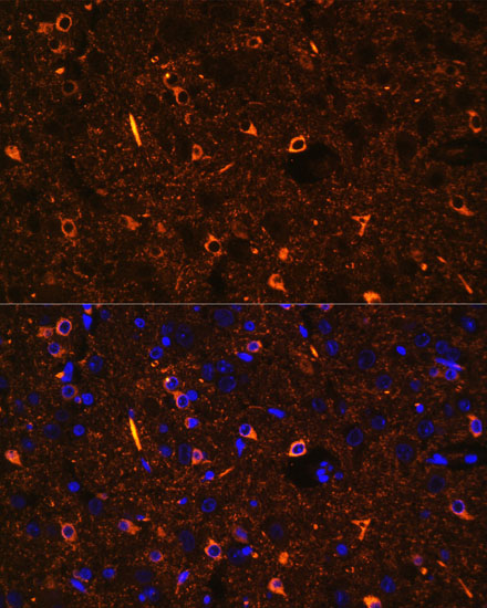 Anti-RTN4 Antibody (CAB1752)