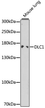 Anti-DLC1 Antibody (CAB1921)