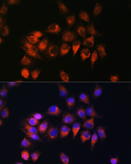 Anti-BDKRB2 Antibody (CAB2844)