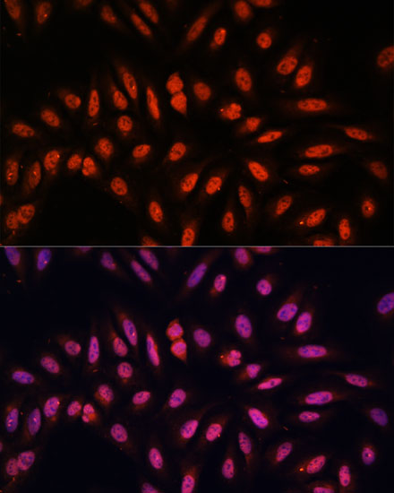 Anti-KLHL8 Antibody (CAB14917)