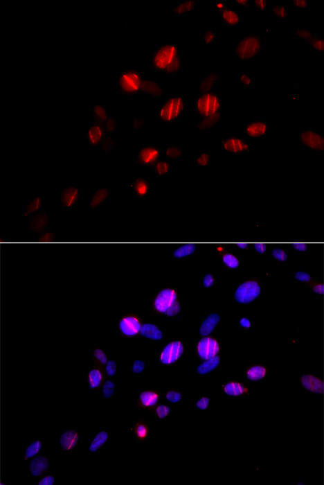 Anti-Rad18 Antibody (CAB13434)