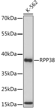 Anti-RPP38 Antibody (CAB17080)