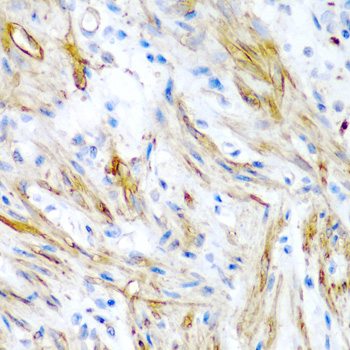 Anti-LMOD1 Antibody (CAB7087)