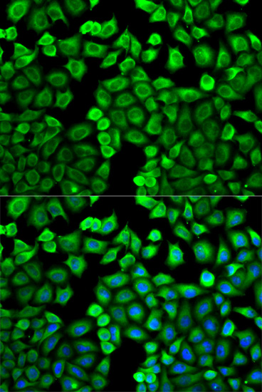 Anti-HNMT Antibody (CAB2520)