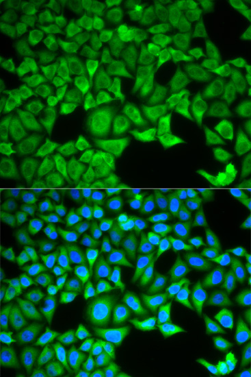 Anti-SLC3A1 Antibody (CAB5500)