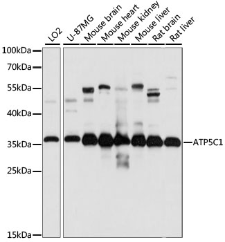 Anti-ATP5C1 Antibody (CAB15257)