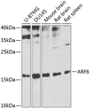 Anti-ARF6 Antibody (CAB0988)