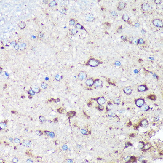 Anti-STARD3NL Antibody (CAB16579)