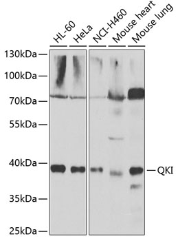 Anti-QKI Antibody (CAB7043)