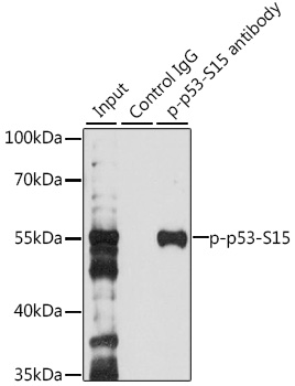 Anti-Phospho-p53-S15 Antibody (CABP0083)