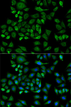 Anti-HP Antibody (CAB14186)