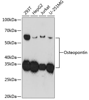 Anti-Osteopontin Antibody (CAB19092)