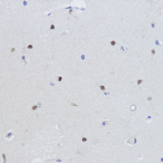 Anti-ESRRA Antibody (CAB14184)