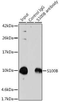 Anti-S100B Antibody (CAB0676)