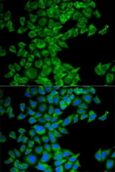 Anti-DIABLO Antibody (CAB13432)