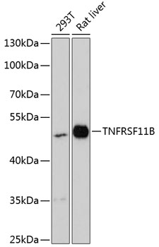 Anti-TNFRSF11B Antibody (CAB13250)