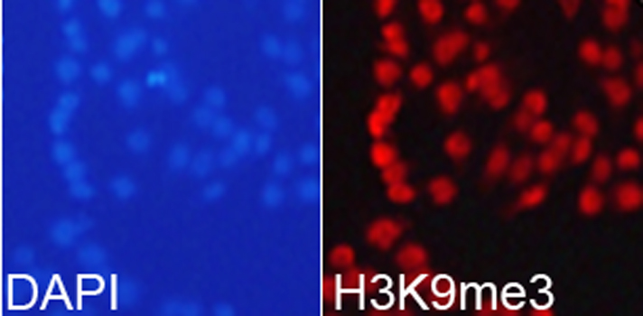 Anti-TriMethyl-Histone H3-K9 Antibody (CAB2360)