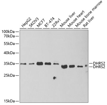 Anti-DHRS2 Antibody (CAB6446)