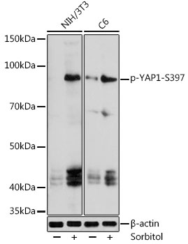 Anti-phospho-YAP1-S397 Antibody (CABP0922)