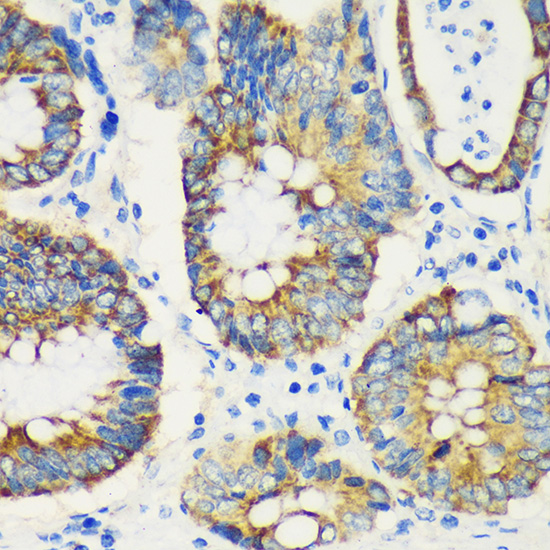 Anti-USP47 Antibody (CAB15461)