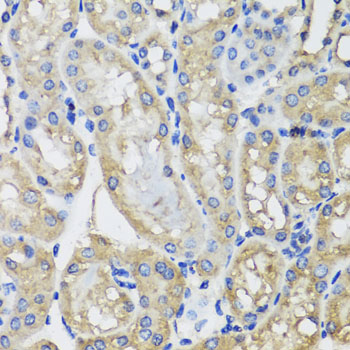 Anti-MRPS22 Polyclonal Antibody (CAB8319)