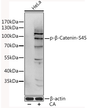 Anti-Phospho-CTNNB1-S45 Antibody (CABP0580)