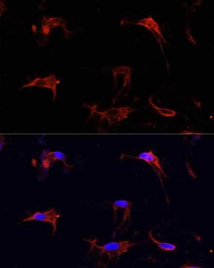 Anti-FBN1 Antibody (CAB16677)