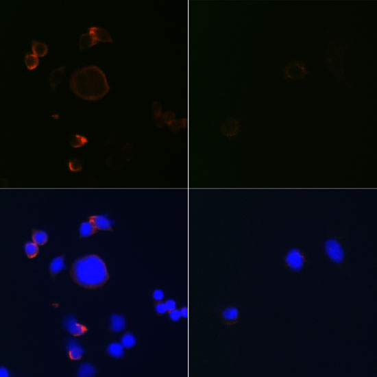 Anti-active + pro Caspase-3 Antibody [KO Validated] (CAB19654)