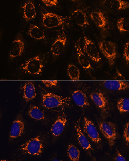 Anti-ACAA2 Antibody (CAB15778)