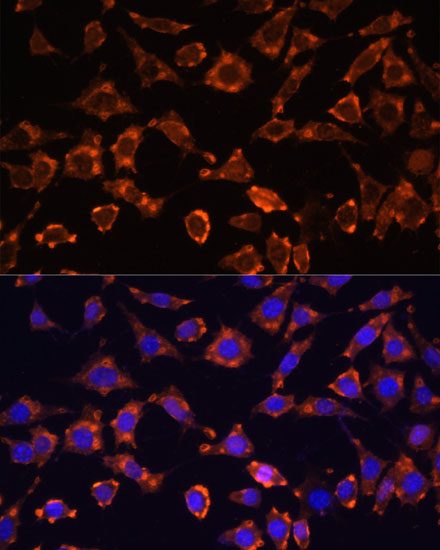 Anti-IL-18 Antibody (CAB16737)