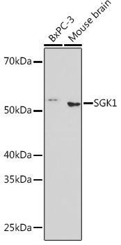 Anti-SGK1 Antibody (CAB3936)