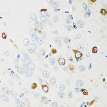 Anti-ELAVL2 Antibody (CAB5918)