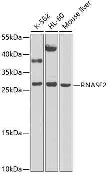 Anti-RNASE2 Polyclonal Antibody (CAB9949)