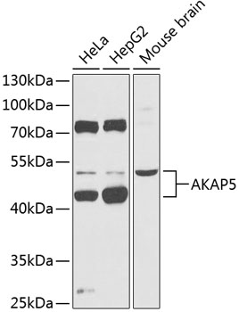 Anti-AKAP5 Antibody (CAB14091)