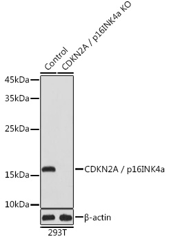 Anti-CDKN2A / p16INK4a Antibody [KO Validated] (CAB0262)