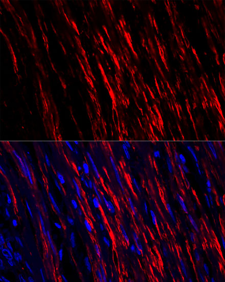 Anti-alpha smooth muscle actin Antibody (CAB7248)