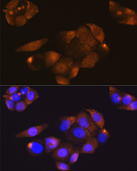 Anti-CDK4[KO Validated] Antibody