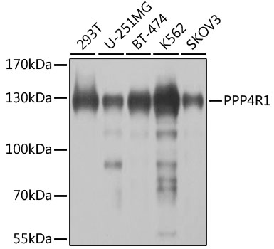 Anti-PPP4R1 Polyclonal Antibody (CAB8361)