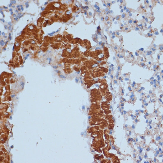 Anti-MTCO1 Antibody (CAB17889)