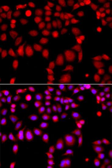 Anti-ARHGEF9 Polyclonal Antibody (CAB7964)