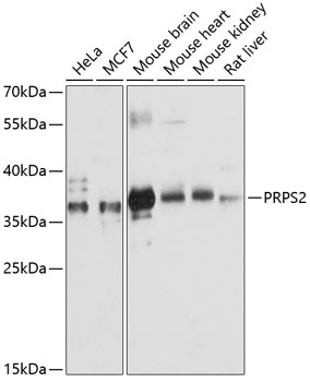 Anti-PRPS2 Antibody (CAB12644)