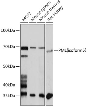 PML (isoform 5) Rabbit Polyclonal Antibody (CAB18182)