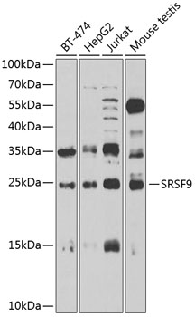 Anti-SFRS9 Antibody (CAB6070)