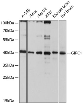 Anti-GIPC1 Antibody (CAB10550)