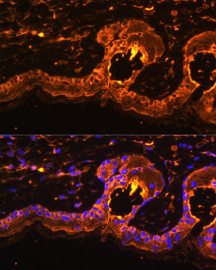 Anti-TYR Antibody (CAB1254)