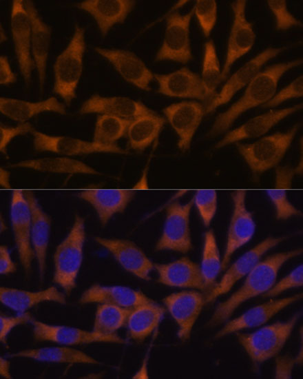 Anti-IGF2BP3 Antibody (CAB6099)