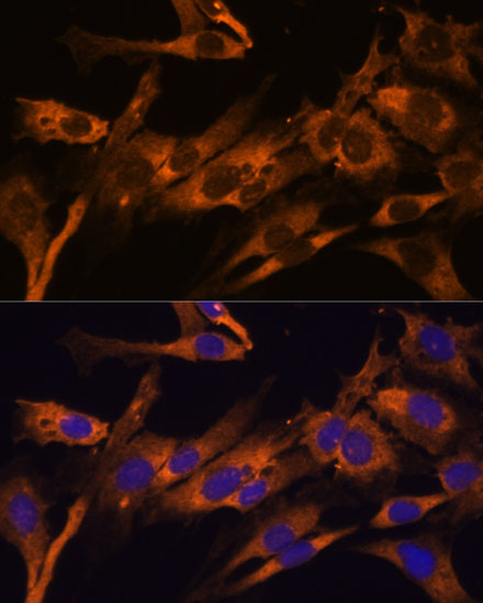 Anti-RPL36AL Antibody (CAB14366)